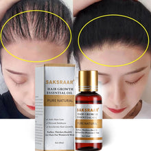 Load image into Gallery viewer, Essential Oils Essence Original Authentic 100% Hair Loss Liquid Dense Hair Growth Serum