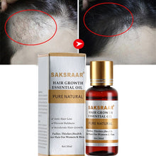 Load image into Gallery viewer, Essential Oils Essence Original Authentic 100% Hair Loss Liquid Dense Hair Growth Serum